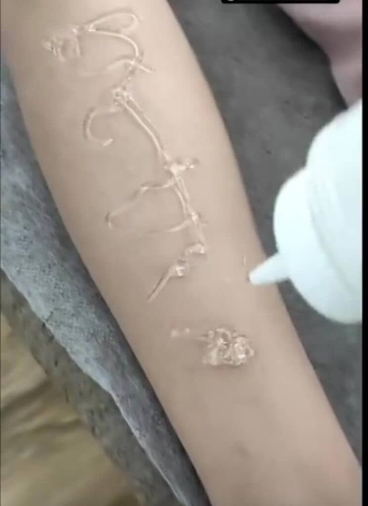 مرکز تخصصی لیزر پروا در شوشتر