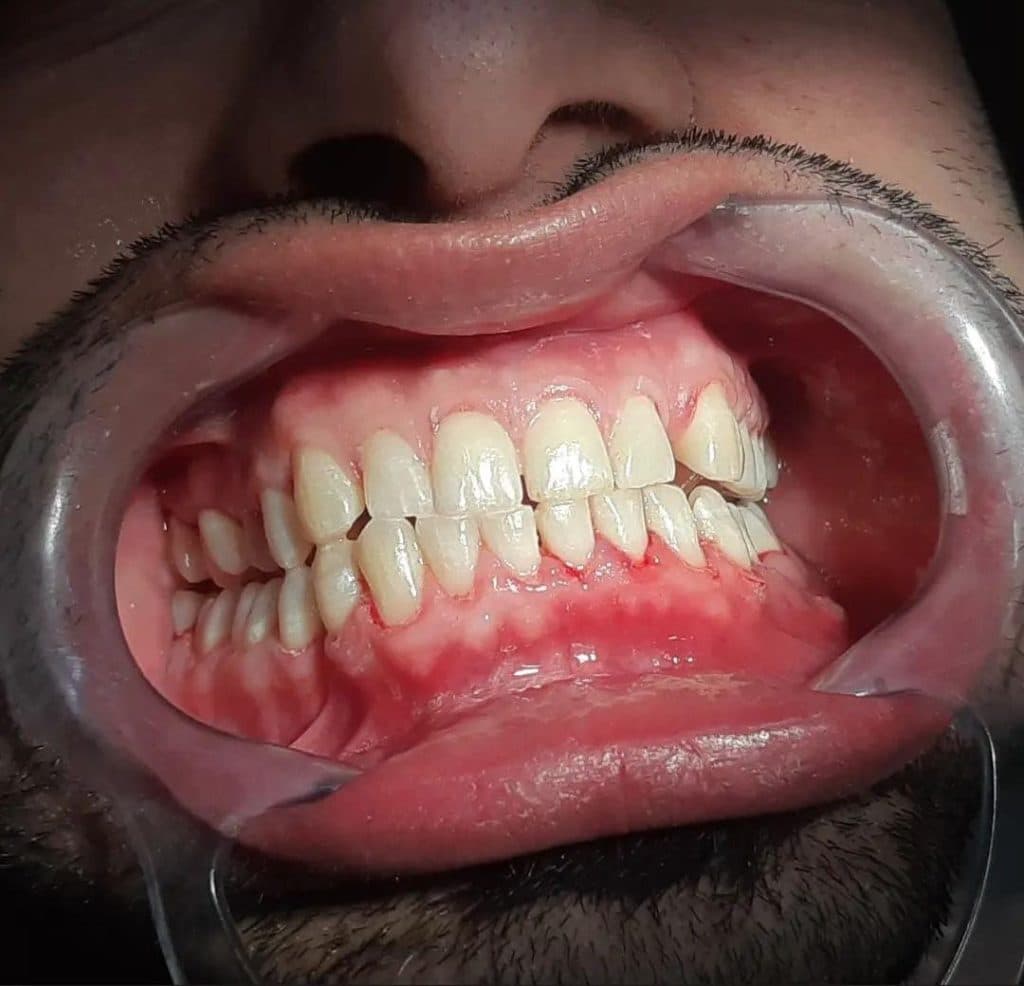 مرکز تخصصی ایمپلنت و زیبایی دندان دکتر نیما اصلاح نیا در رشت