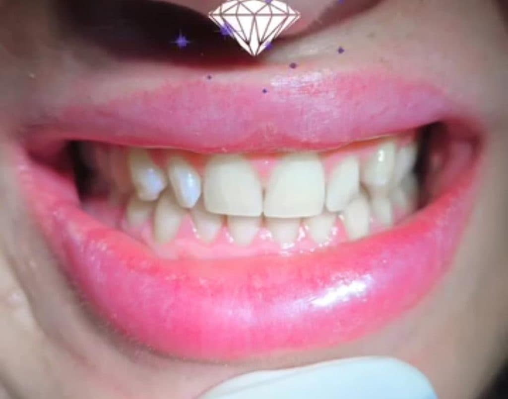 مرکز تخصصی ایمپلنت و زیبایی دندان دکتر نیما اصلاح نیا در رشت