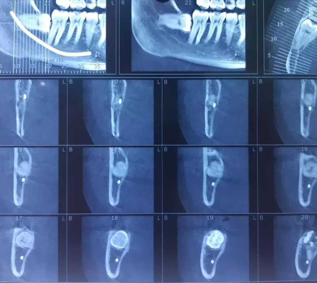 مرکز تخصصی ایمپلنت و زیبایی دندان دکتر نیما اصلاح نیا در رشت