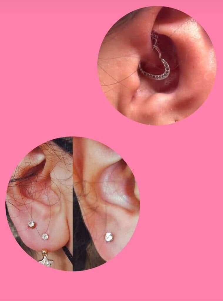 مرکز زیبایی لیزر رها در ساوه