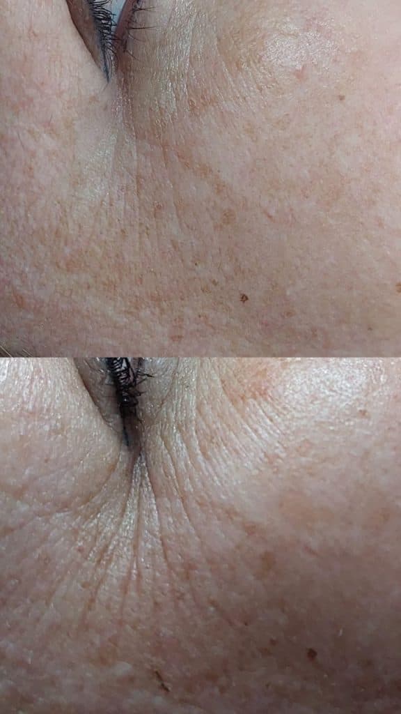 مرکز لاغری مدرن در ارومیه