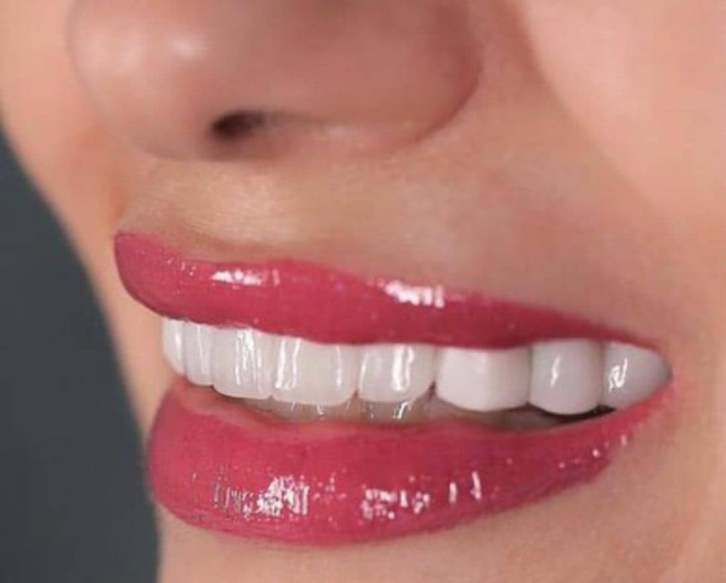 دندانپزشکی شاین در کرج