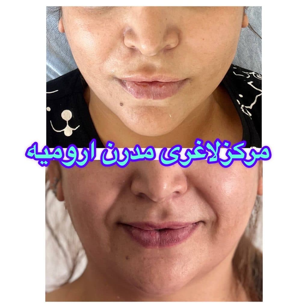 مرکز لاغری مدرن در ارومیه