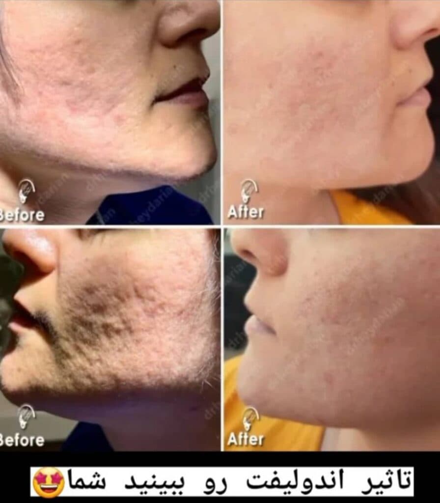 مرکز زیبایی لیزر رها در ساوه