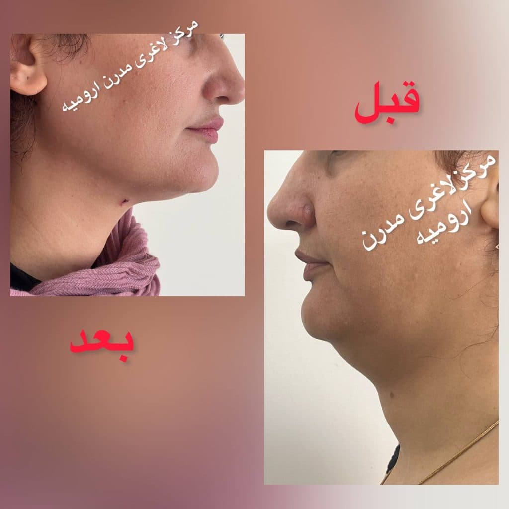 مرکز لاغری مدرن در ارومیه