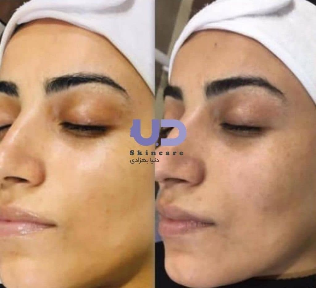 سالن زیبایی دنیا بهزادی در اهواز