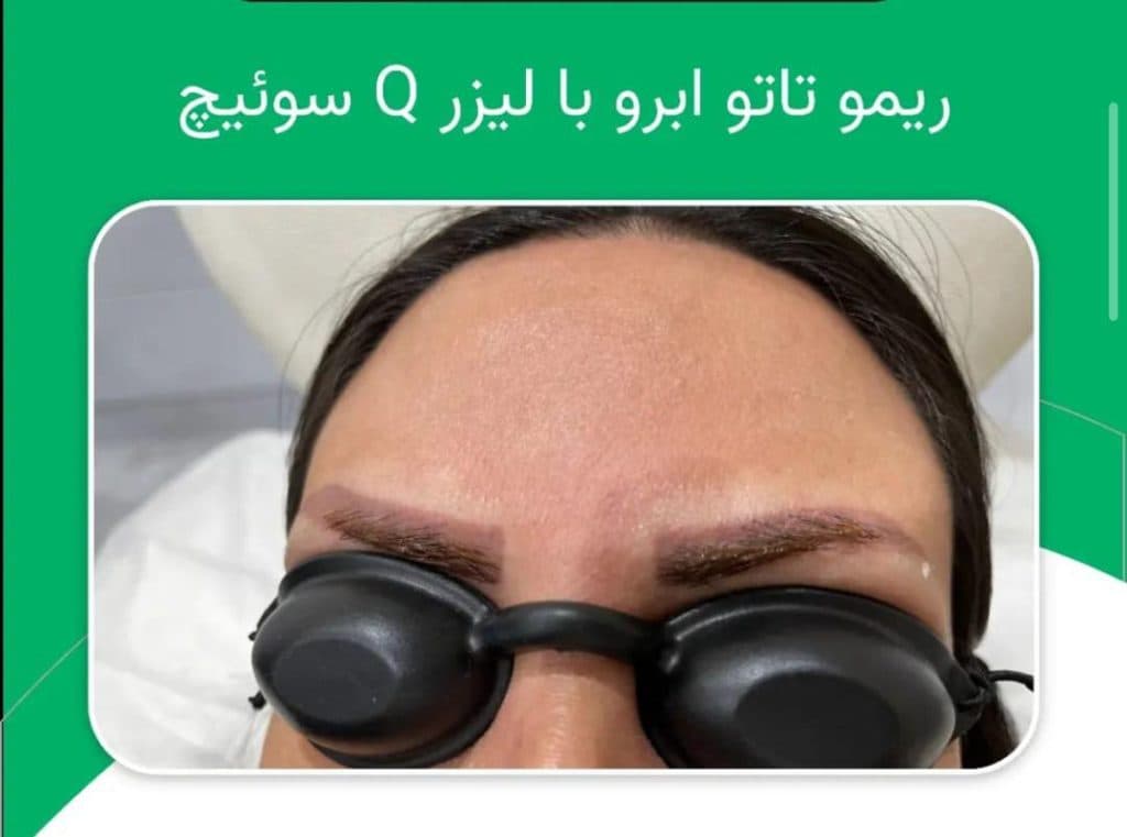 کلینیک زیبایی پوست و مو هیلدا در تبریز