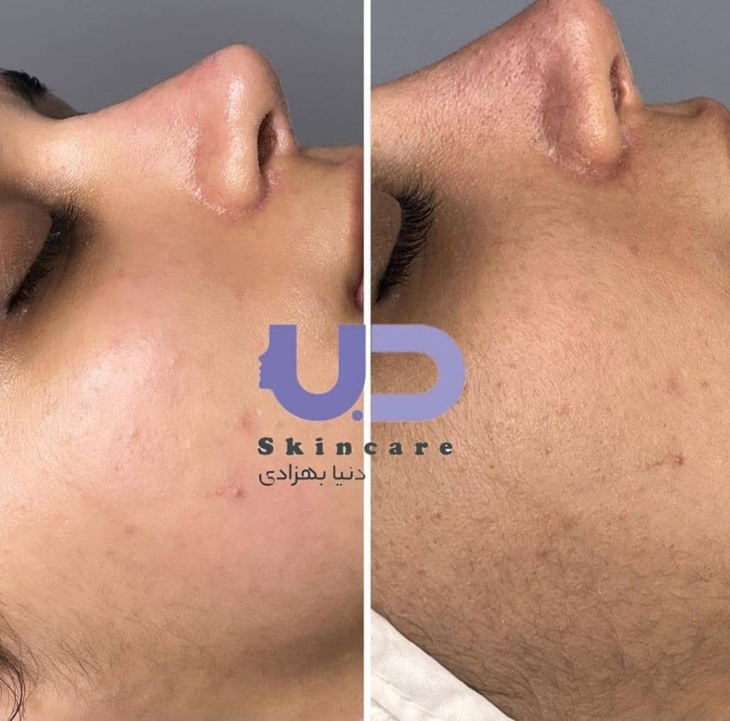 سالن زیبایی دنیا بهزادی در اهواز