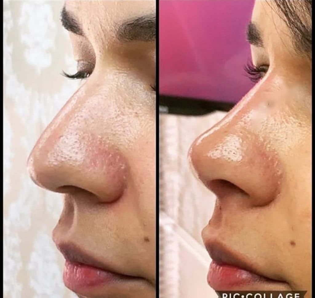 کلینیک عمل جراحی بینی اشکا در اهواز