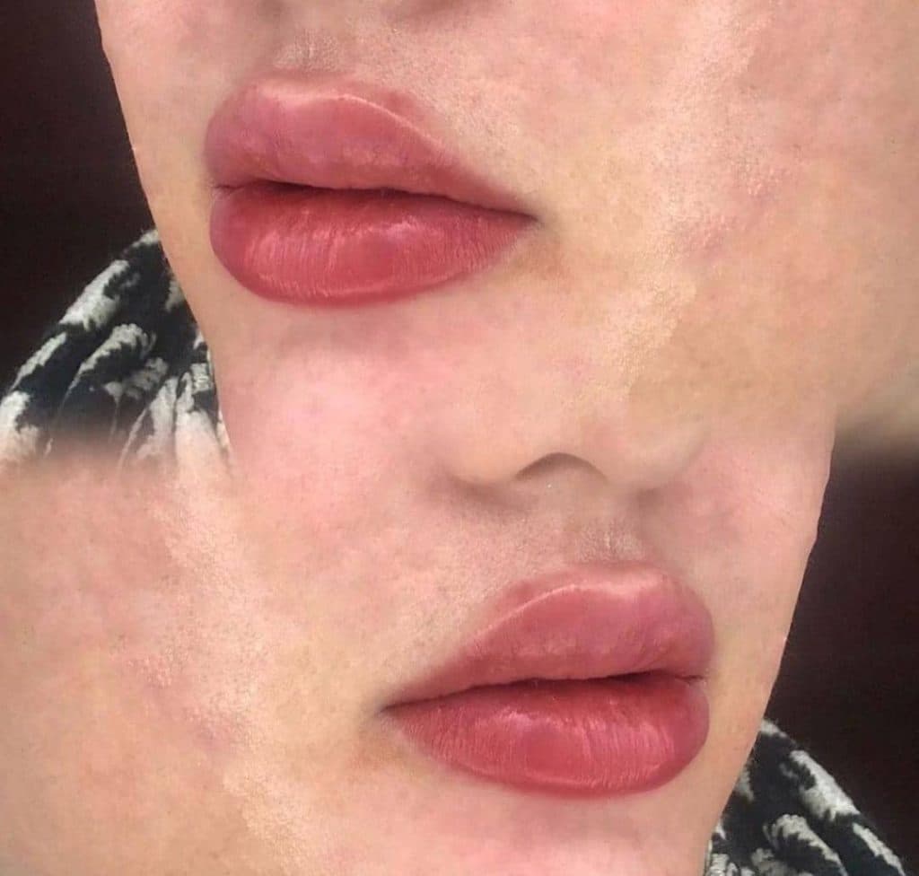 کلینیک زیبایی پوست و مو مروا در کرج