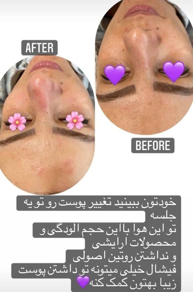 آموزشگاه فنی حرفه ای پاکسازی پوست زهرا نجفی در نظرآباد