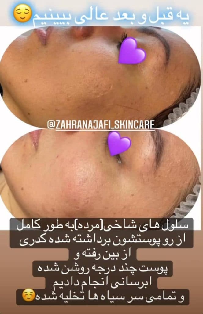 آموزشگاه فنی حرفه ای پاکسازی پوست زهرا نجفی در نظرآباد