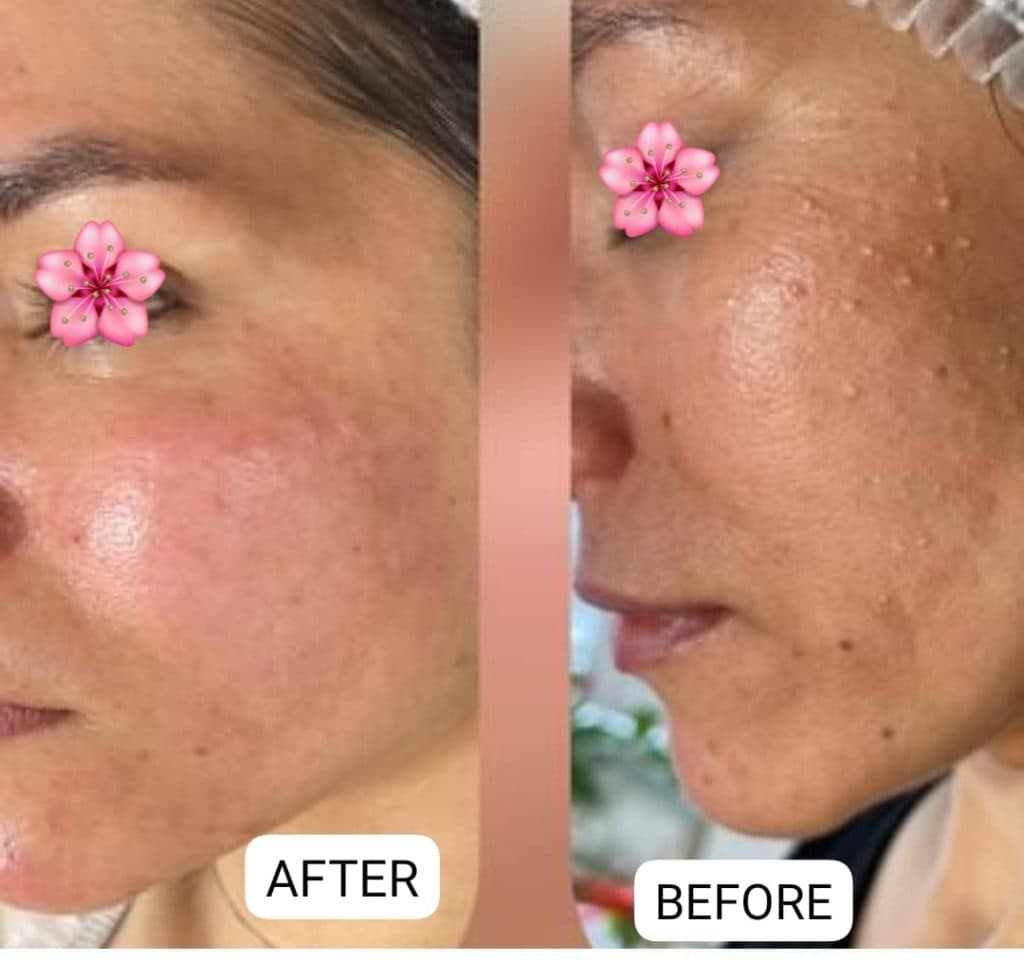 آموزشگاه فنی حرفه ای پاکسازی پوست زهرا نجفی در نظرآباد