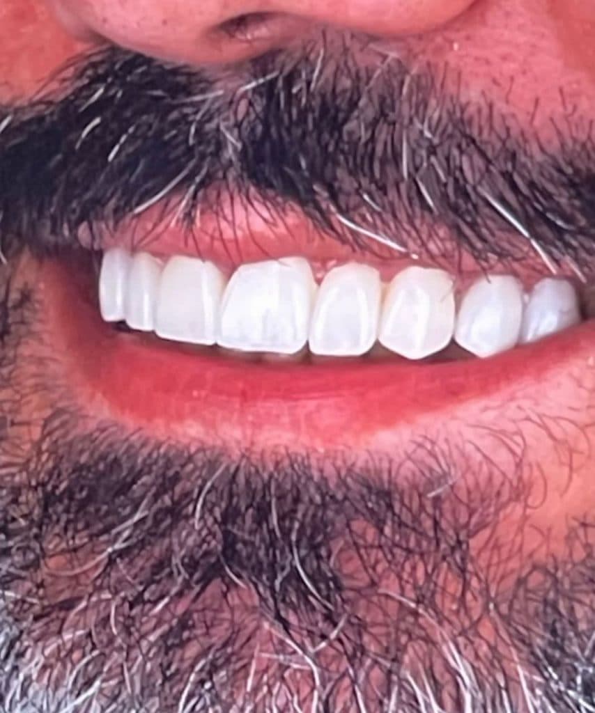 کلینیک زیبایی لاغری موضعی مریت در گلسار رشت