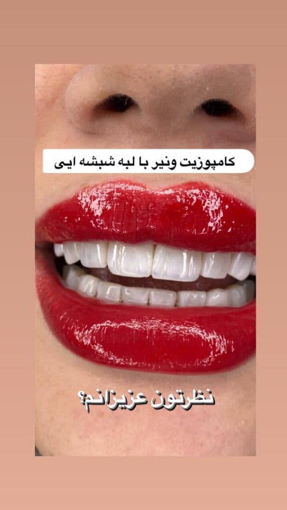 کلینیک تخصصی کامپوزیت و ایمپلنت دندان کیارش در رشت