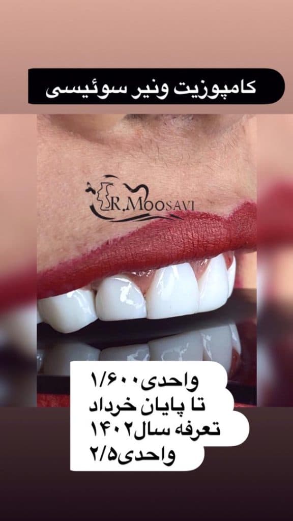 کلینیک تخصصی کامپوزیت و ایمپلنت دندان کیارش در رشت