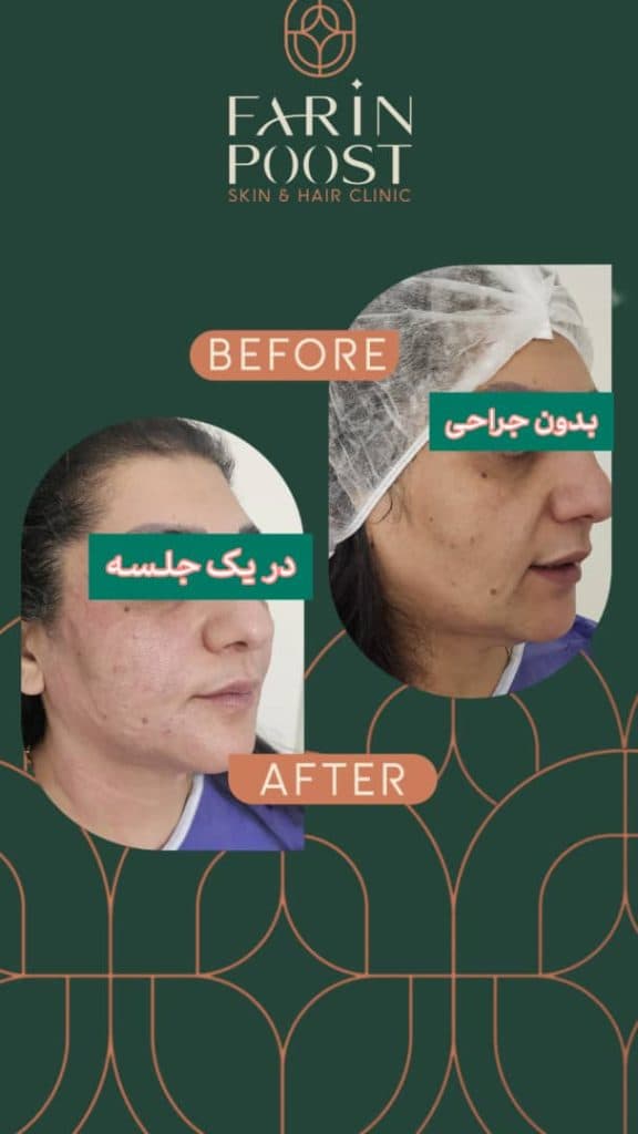 مرکز زیبایی پوست و مو فرین پوست در مصلی اصفهان