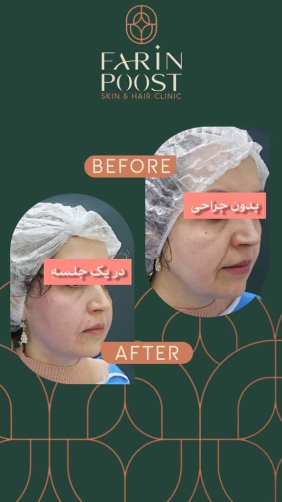 مرکز زیبایی پوست و مو فرین پوست در مصلی اصفهان