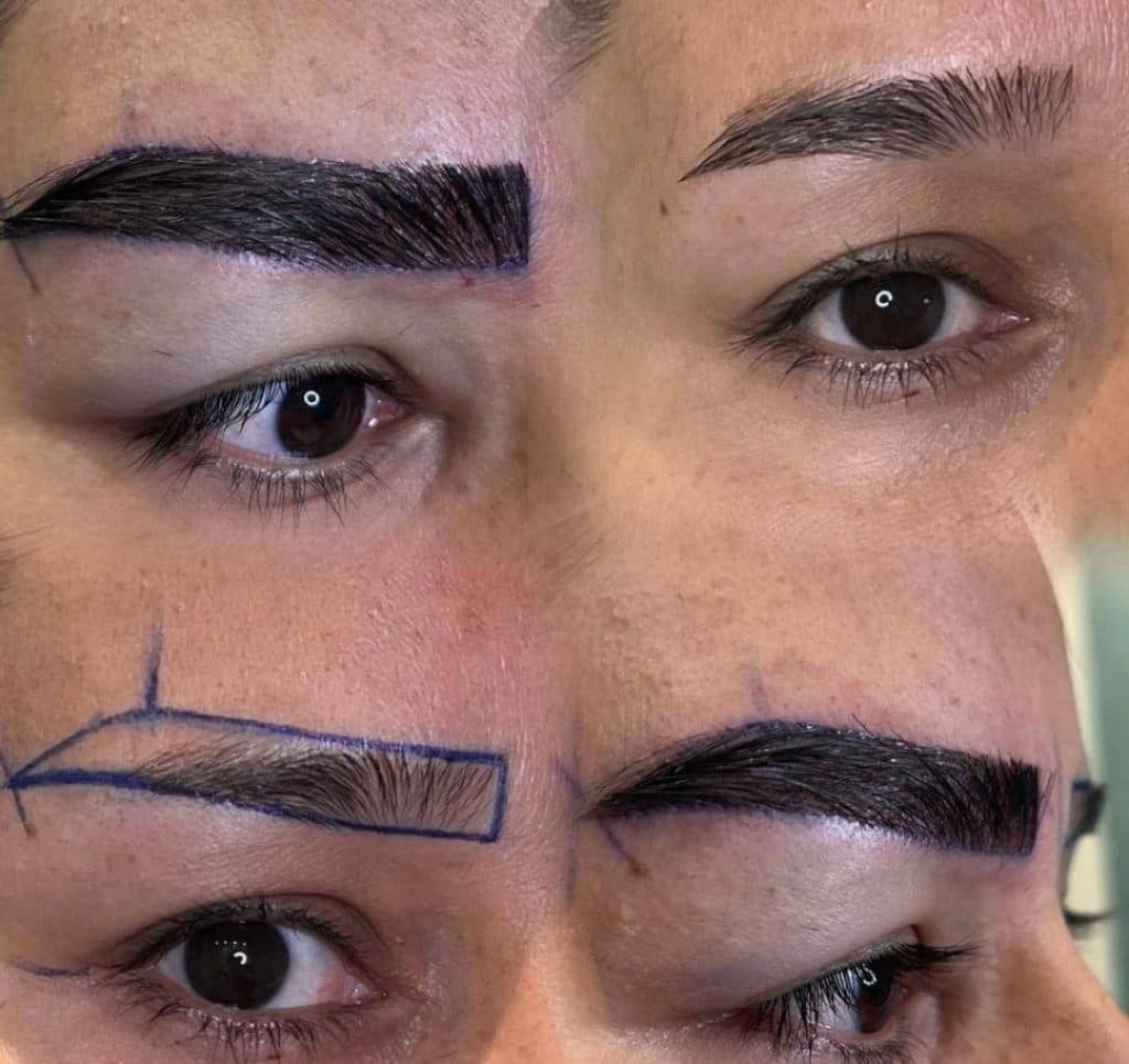 آموزش و خدمات کاشت مو و ابرو عباس زاده در تبریز