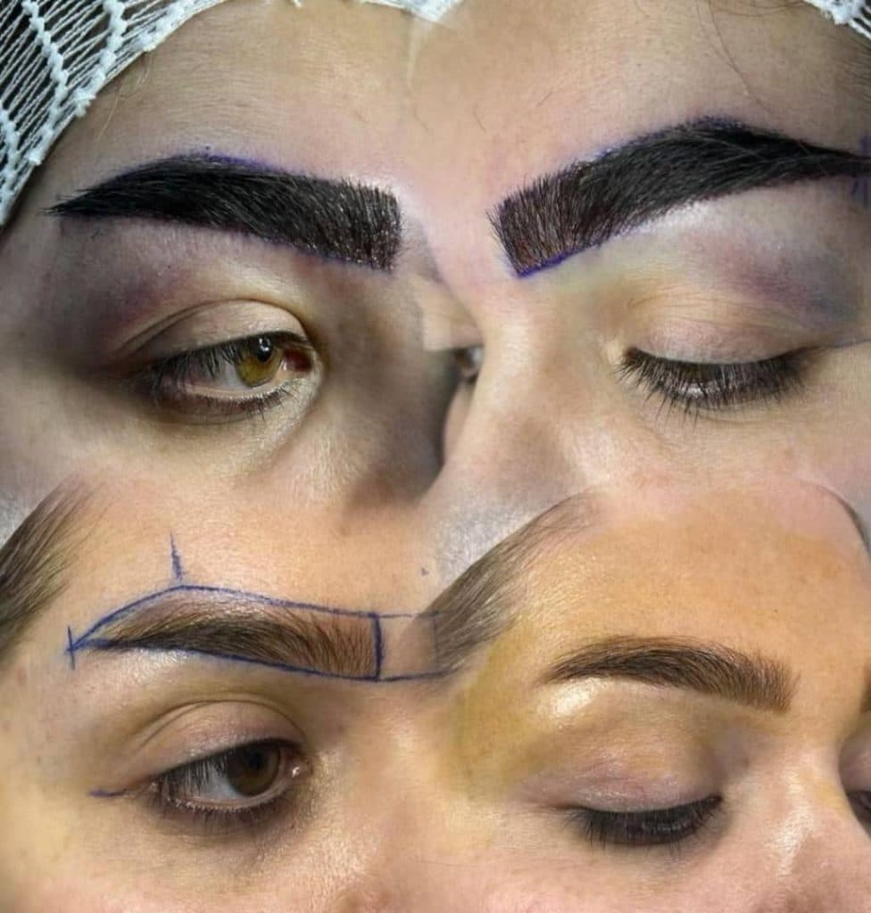 آموزش و خدمات کاشت مو و ابرو عباس زاده در تبریز