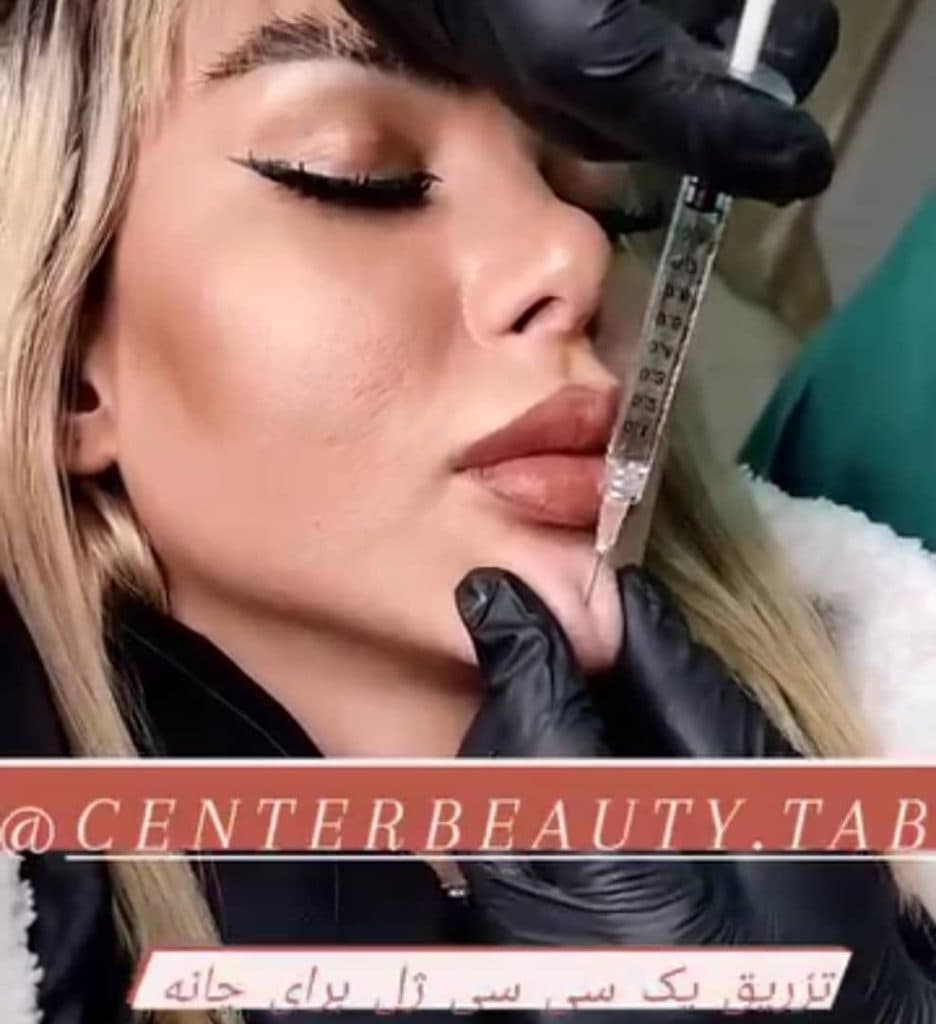 مرکز تخصصی زیبایی بهنود در تبریز