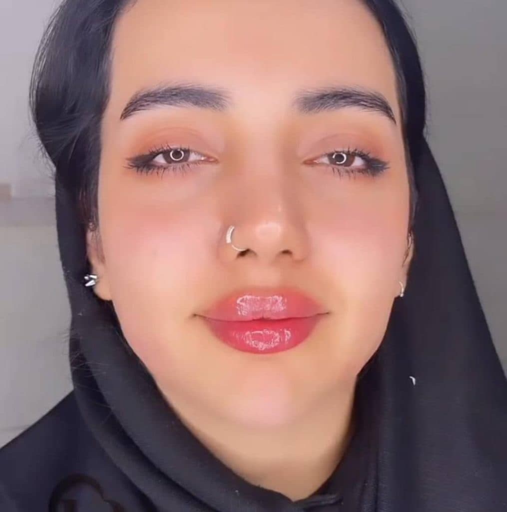 مرکز تخصصی زیبایی بهنود در تبریز