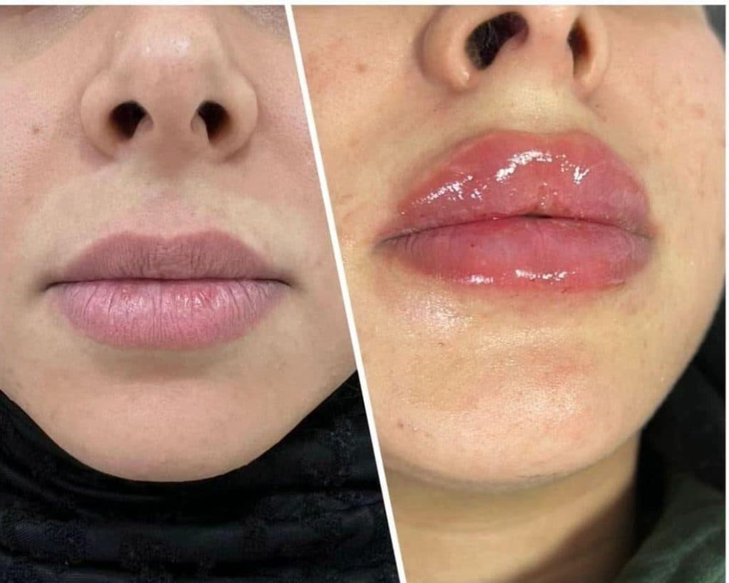 مرکز تخصصی پوست و مو هوژین در رفسنجان