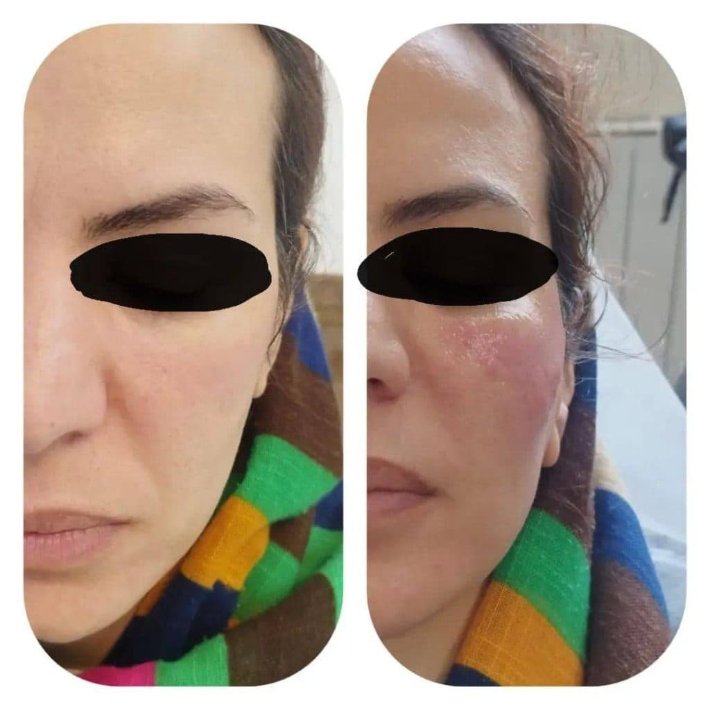 مرکز تخصصی پوست و مو هوژین در رفسنجان