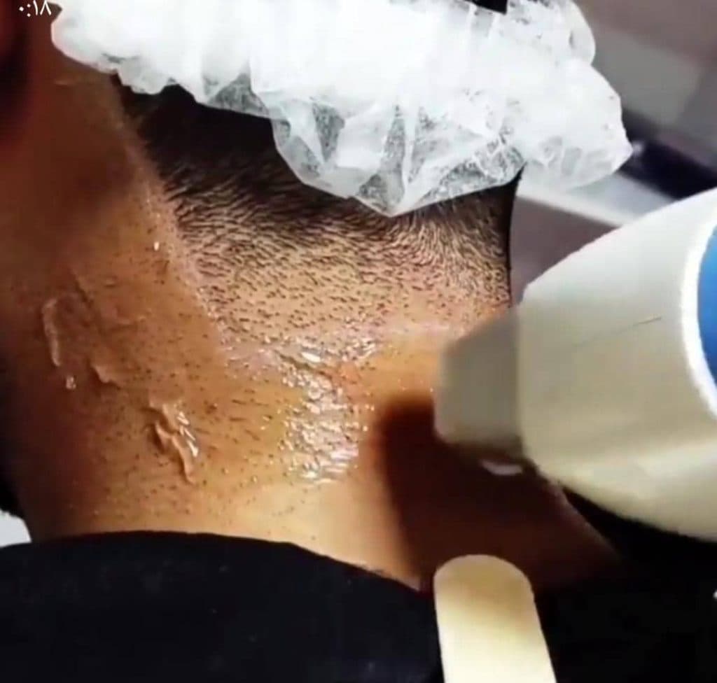 مرکز تخصصی لیزر موهای زائد سنا در کرمان