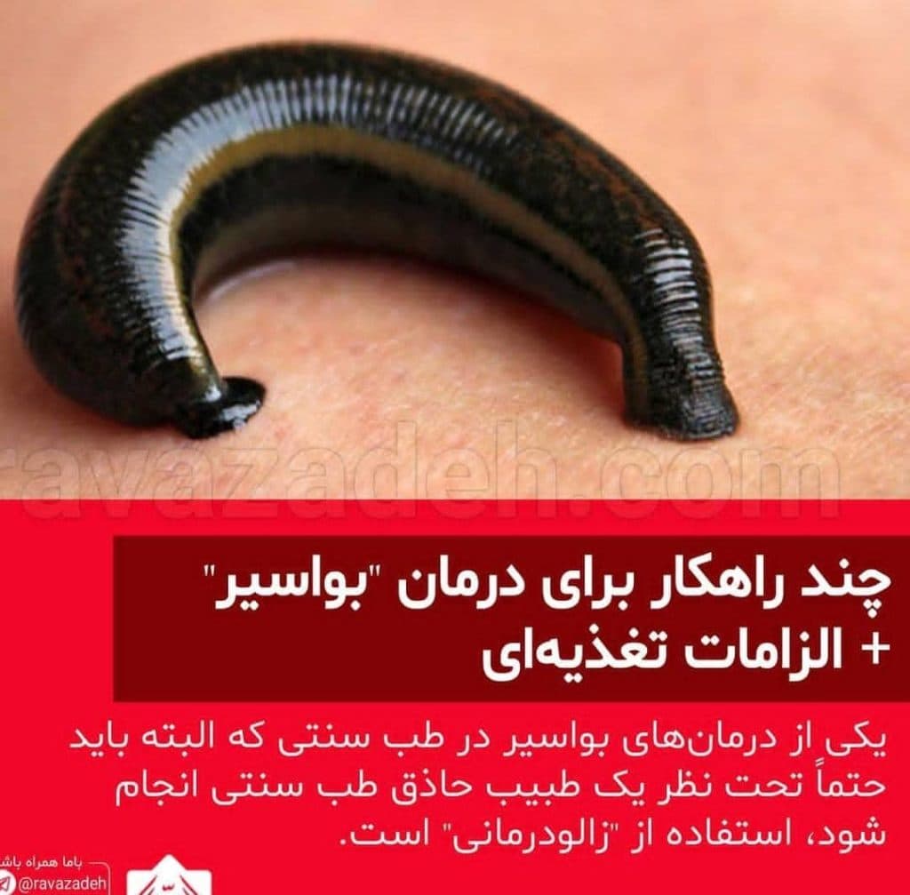 آموزشگاه و خدمات ماساژ حیات در گرگان