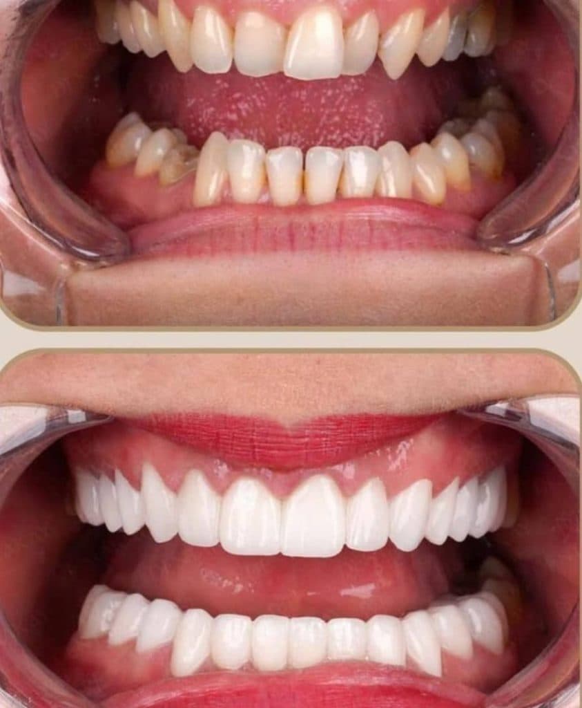 مطب دندانپزشکی دکتر سپیده علیزاه در تبریز