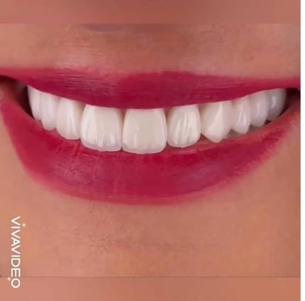 مطب دندانپزشکی دکتر سپیده علیزاه در تبریز