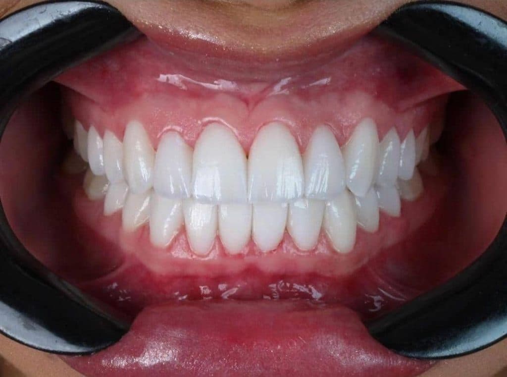 مطب دندانپزشکی دکتر سپیده علیزاه در تبریز