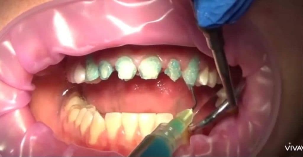 مطب دندانپزشکی دکتر سپیده علیزاه در تبریز