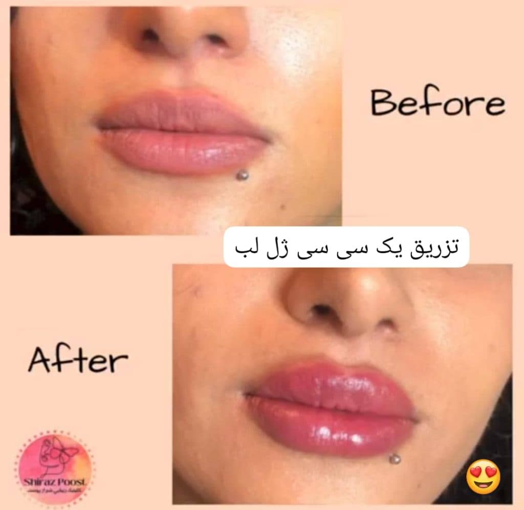 کلینیک زیبایی پوست و مو شیراز پوست زارع در شیراز