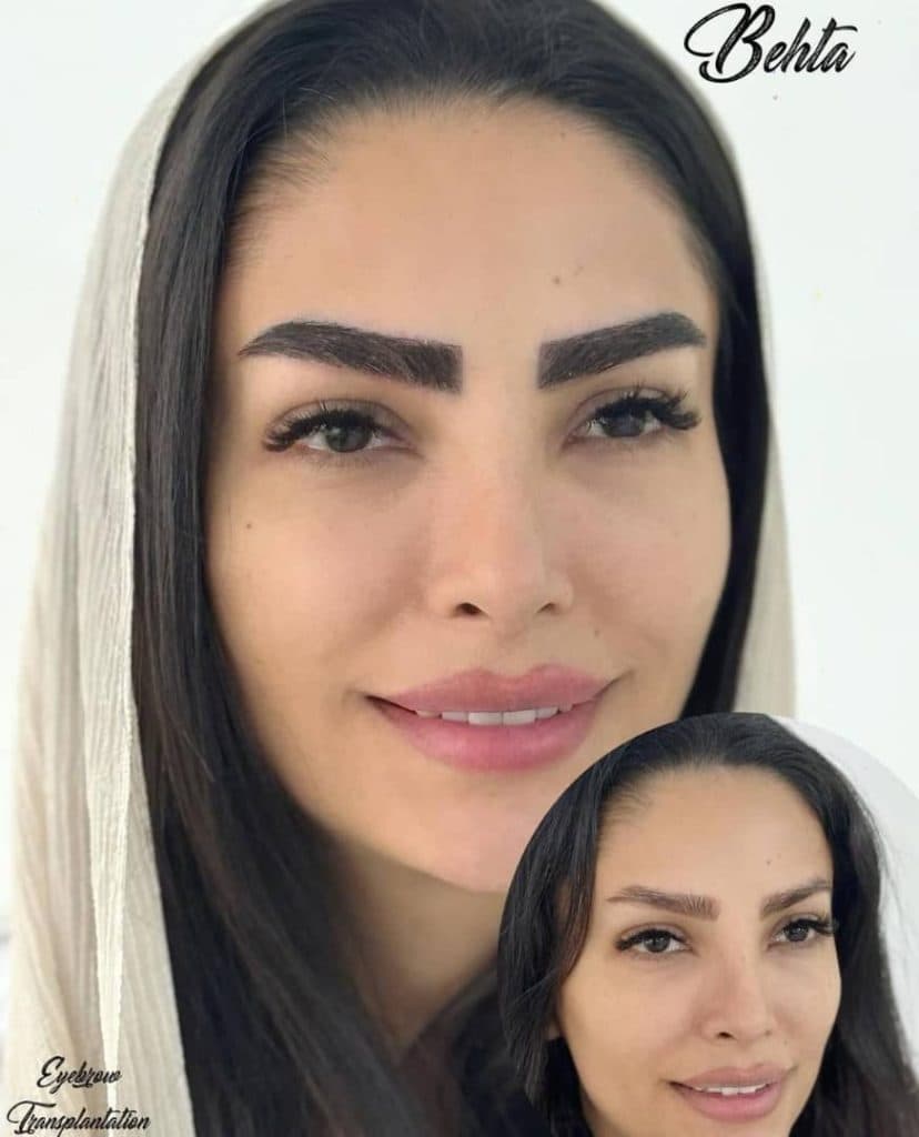 کلینیک زیبایی پوست و مو بهتا در کرج