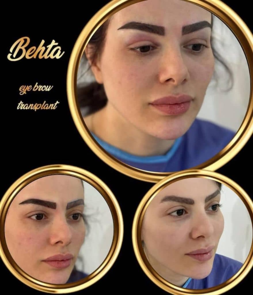 کلینیک زیبایی پوست و مو بهتا در کرج