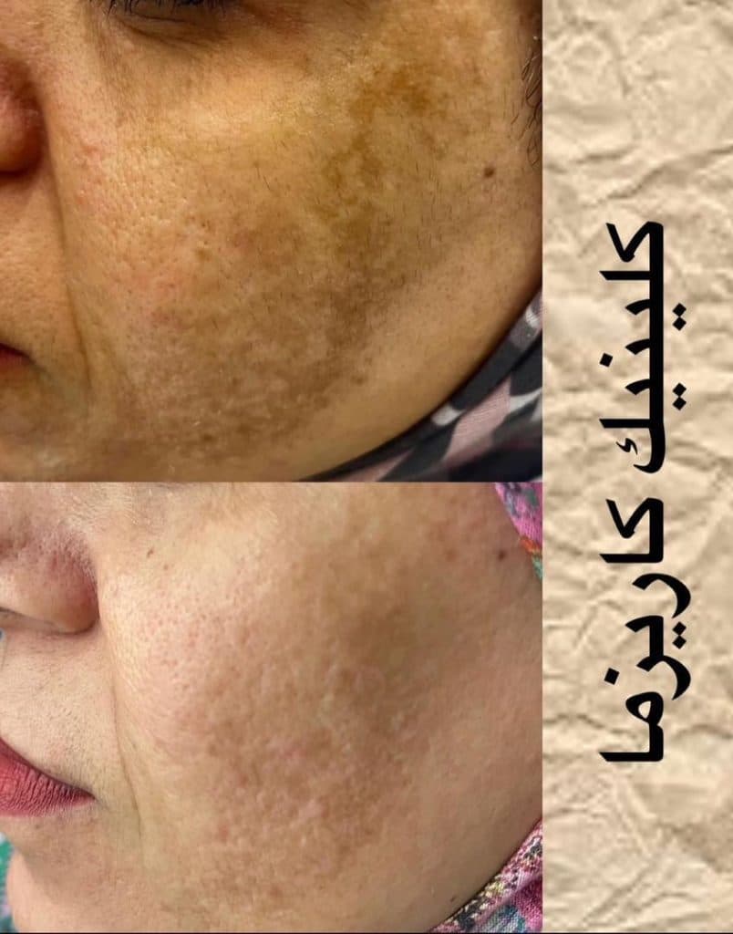 کلینیک تخصصی زیبایی لاغری کاریزما در بندرعباس