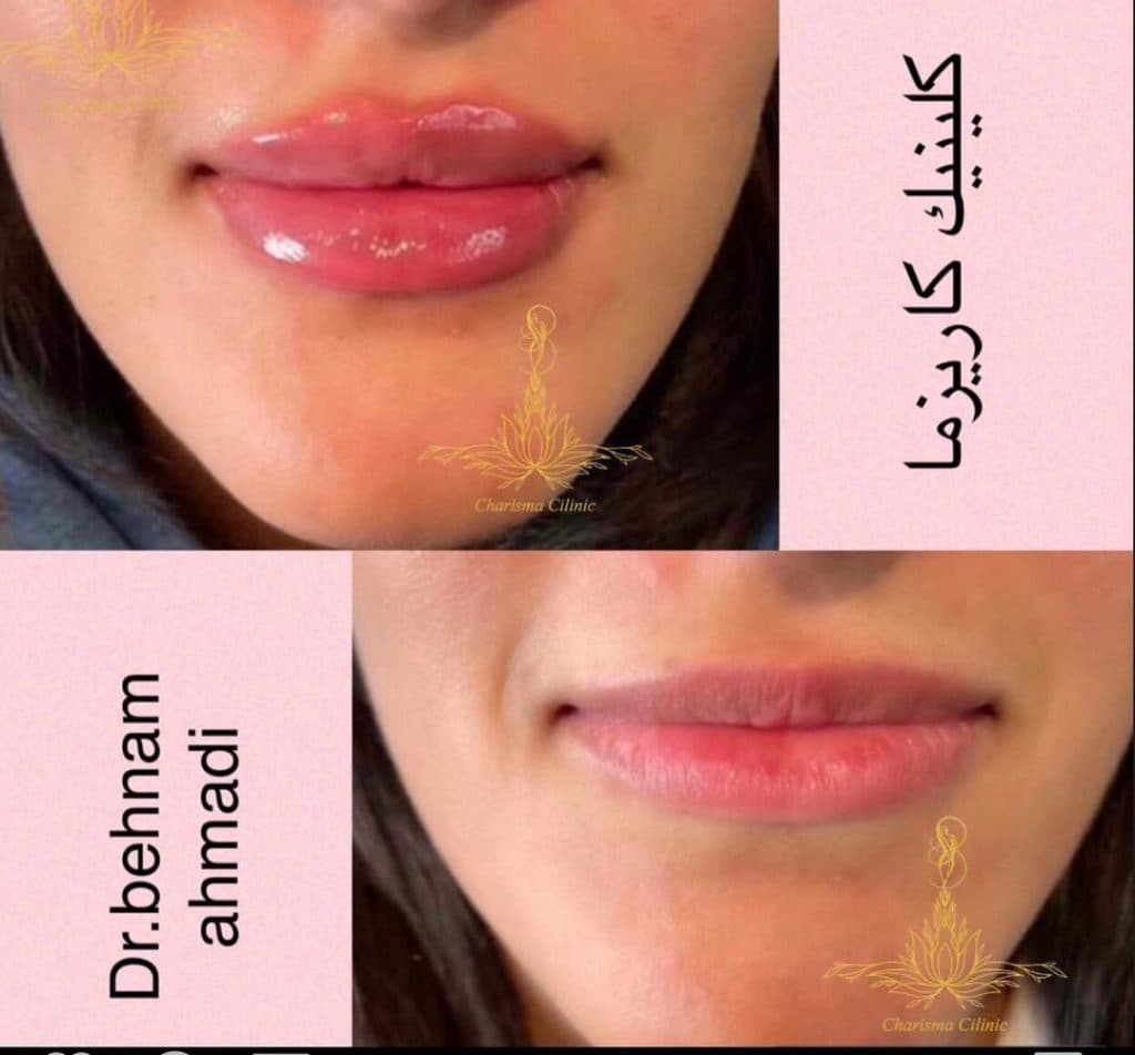 کلینیک تخصصی زیبایی لاغری کاریزما در بندرعباس