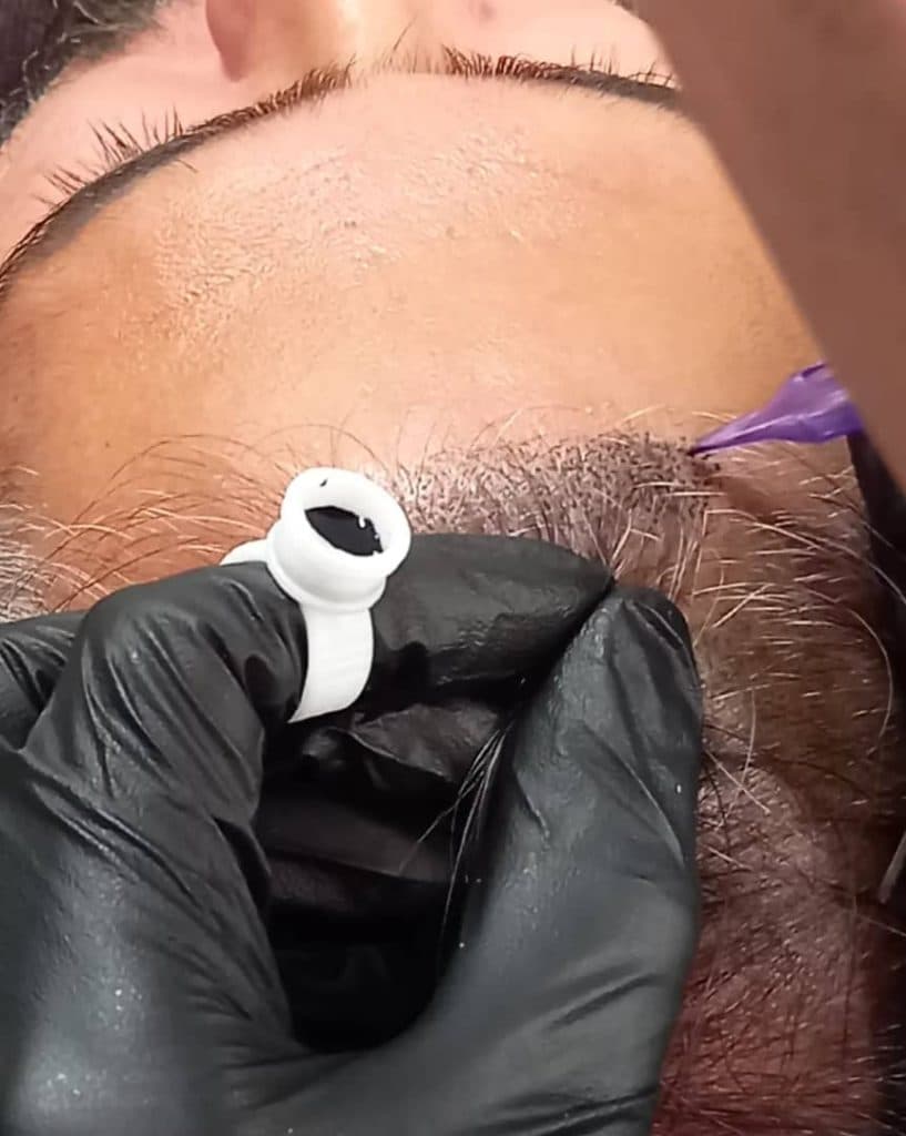 خدمات میکرواسکالپ و اسکالپ سر مریم شکری در مهرشهر کرج