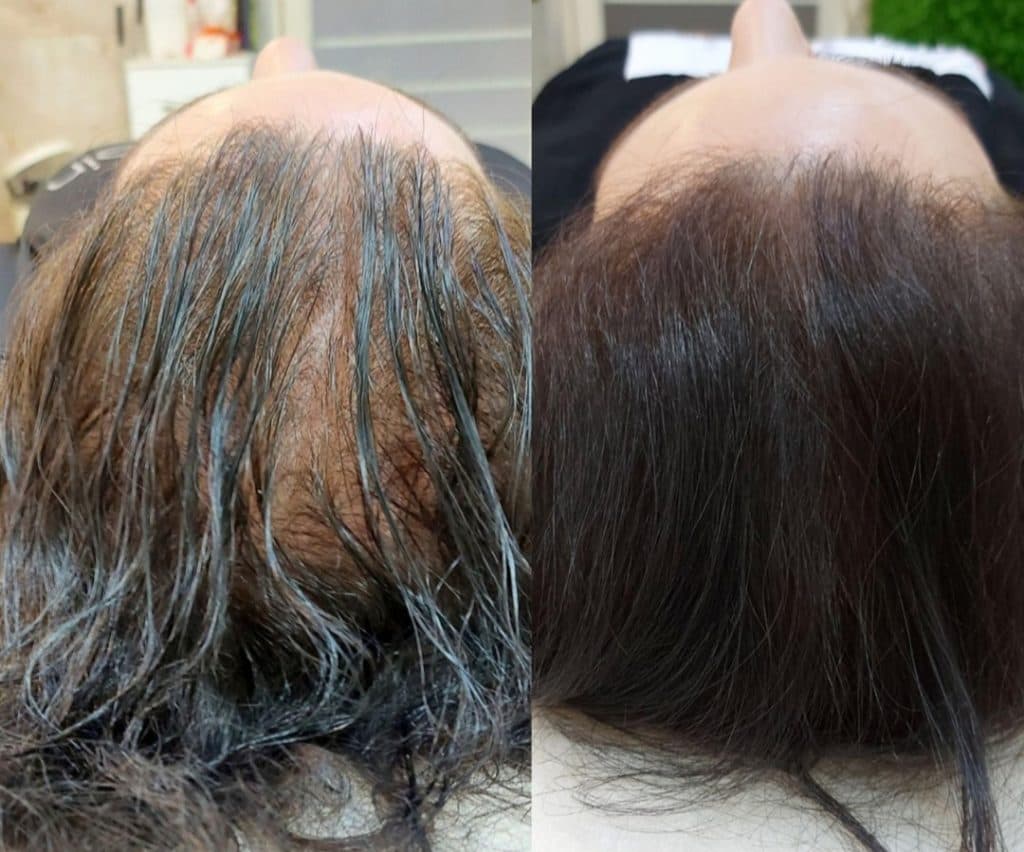 خدمات میکرواسکالپ و اسکالپ سر مریم شکری در مهرشهر کرج