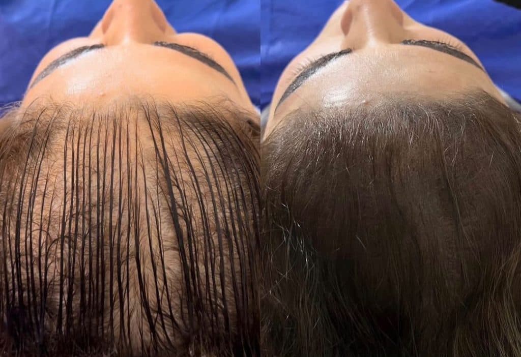 خدمات میکرواسکالپ و اسکالپ سر مریم شکری در مهرشهر کرج