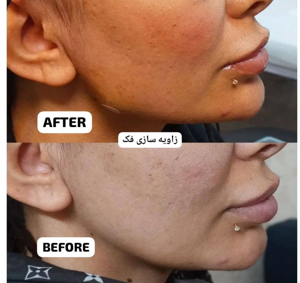 کلینیک زیبایی پوست و مو الماس در مشهد