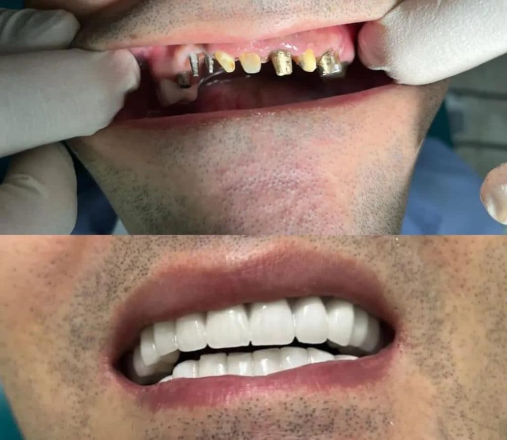 لابراتوار پروتزهای دندانی سارزی در صادقیه تهران