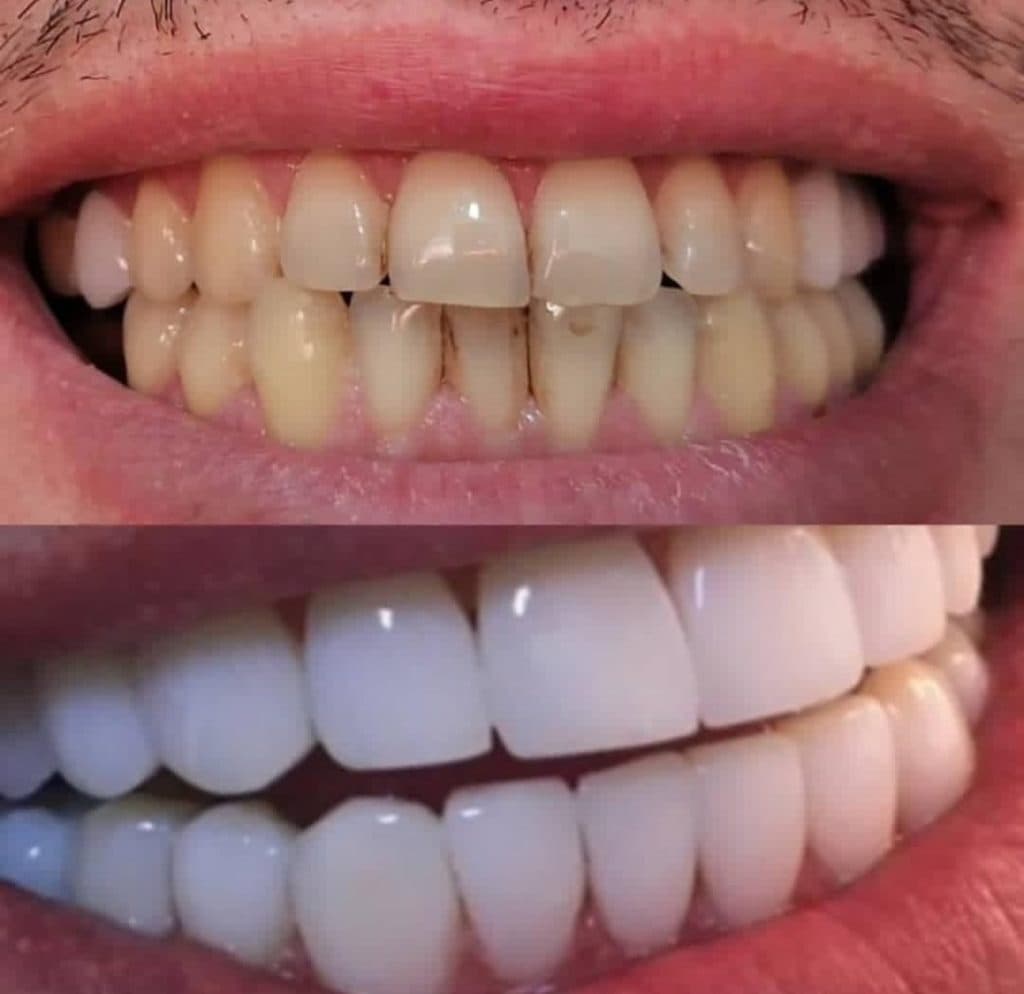 لابراتوار پروتزهای دندانی سارزی در صادقیه تهران