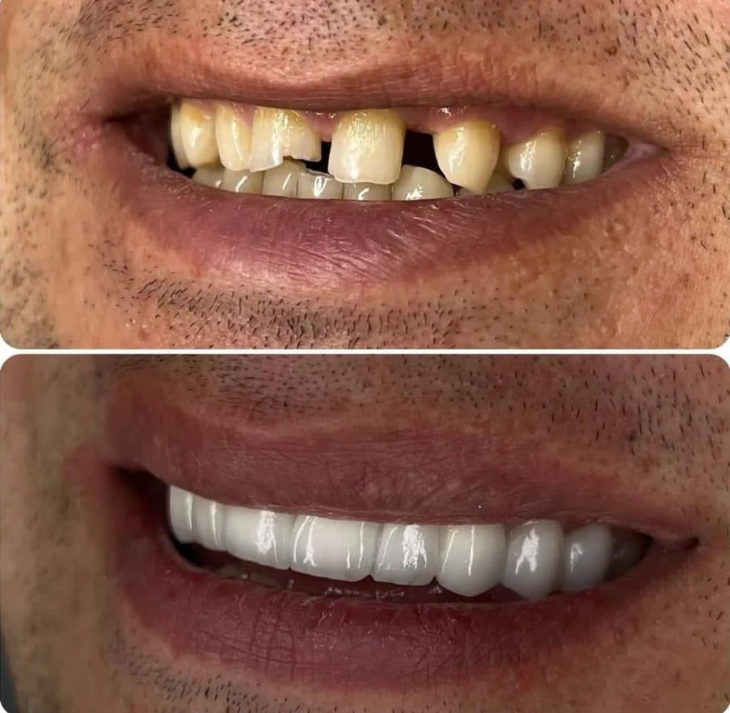 لابراتوار پروتزهای دندانی سارزی در صادقیه تهران