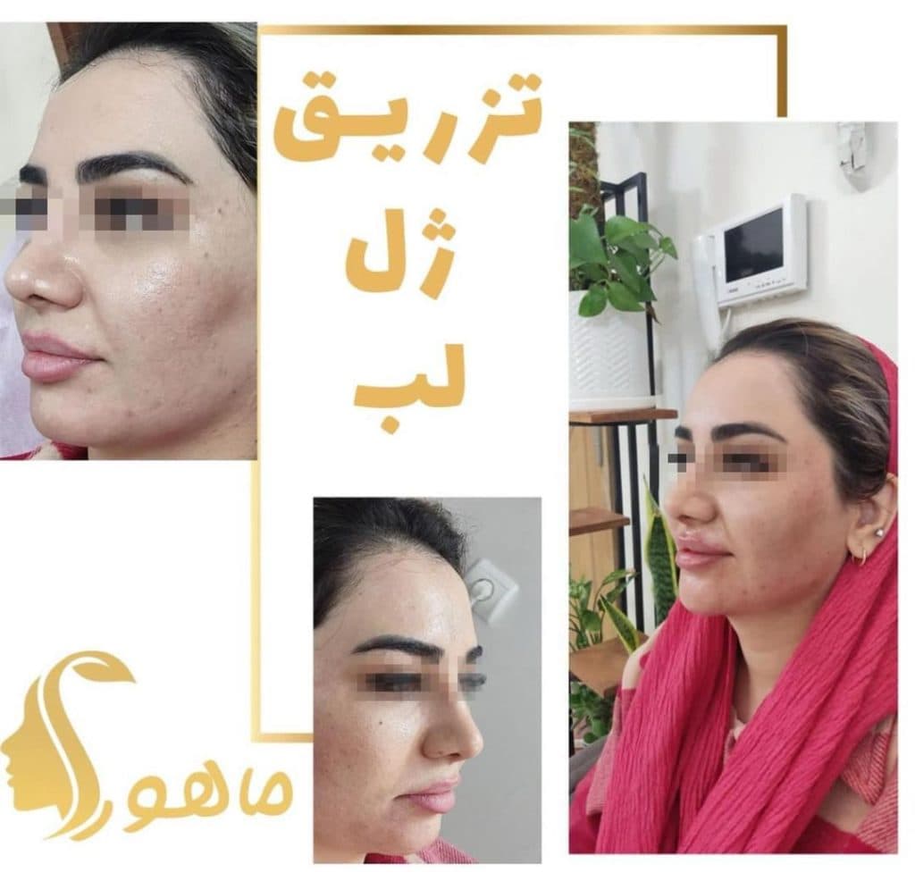 مطب زیبایی پوست و مو ماهورا در گاندی تهران