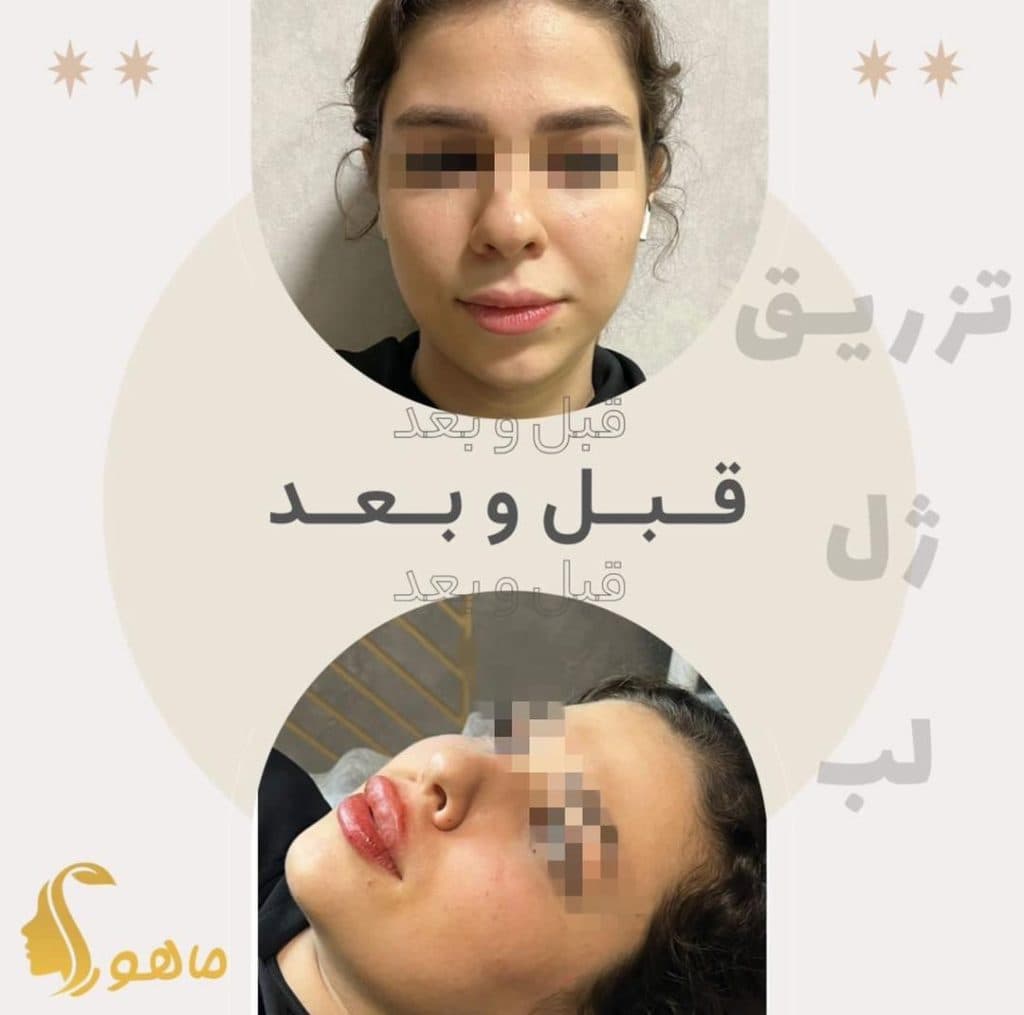 مطب زیبایی پوست و مو ماهورا در گاندی تهران