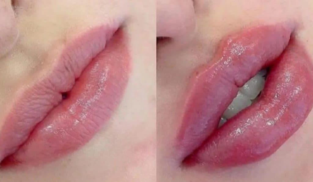 کلینیک زیبایی لیزر راسپینا در امیرکبیر کرمان